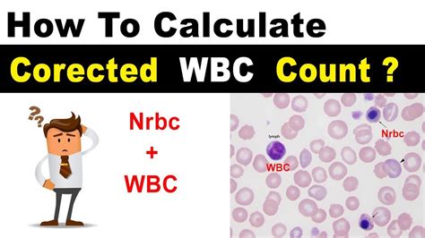 absolute wbc count calculator|calculate corrected wbc count.